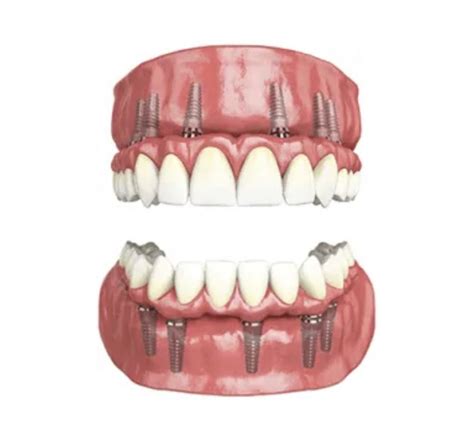 affordable dental conroe tx|Affordable Dentures & Implants in Conroe, TX